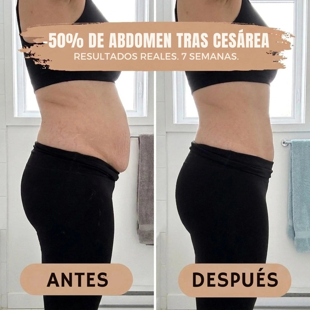 RosaVeluxe® — Braga Moldeadora Postparto 360°