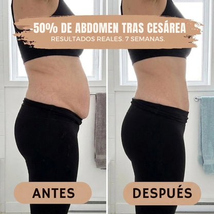 RosaVeluxe® — Braga Moldeadora Postparto 360°