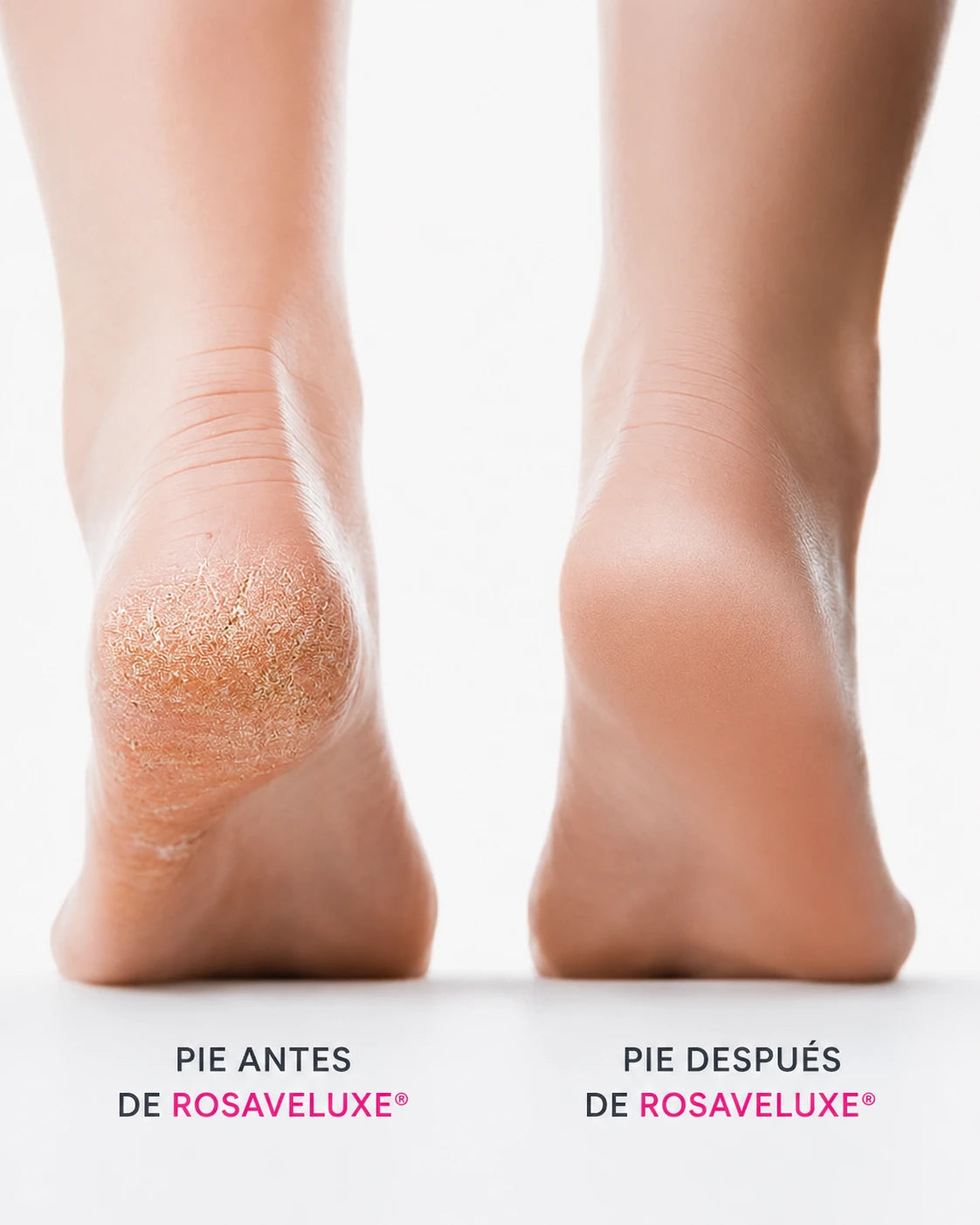 RosaVeluxe® Silk 3 Pro – Lima Eléctrica para Pies