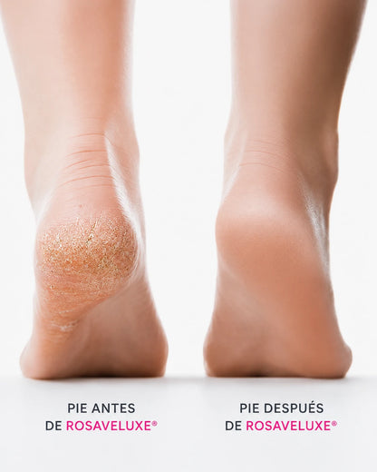RosaVeluxe® Silk 3 Pro – Lima Eléctrica para Pies