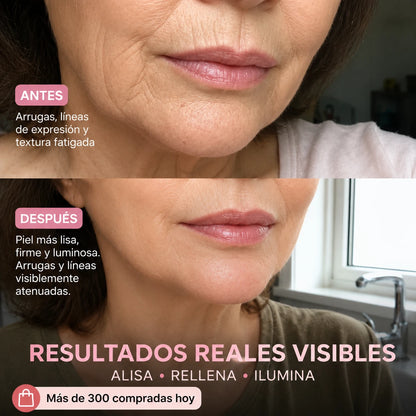Stick Rellenador Bio-Colágeno PDRN