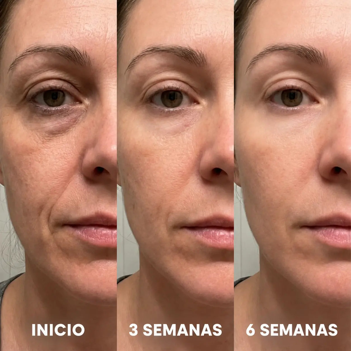 RosaVeluxe® — Stick Rellenador Bio-Colágeno Lifting